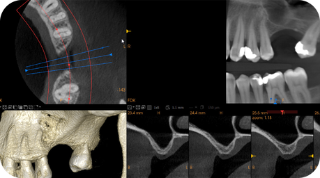 Flujo de trabajo Radiología