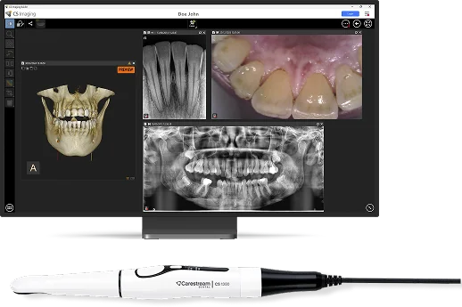 CS Imaging mostrando fotografías intraorales junto a radiografías y tomografía.