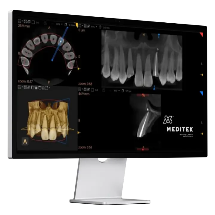 Meditek Tomografías.webp