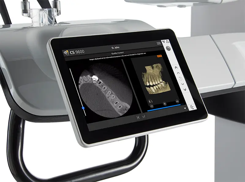 CS 9600 en operación con Live Positioning Assistant